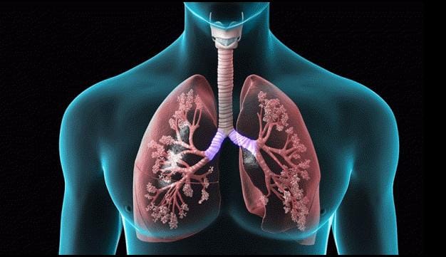 Save Your Breath: Why Do So Many Suffer From Copd?